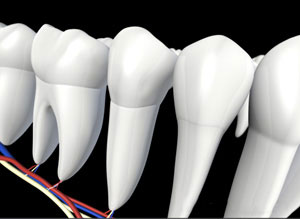 3D dental illustration showing tooth cross-section with root canal treatment anatomy and instruments.