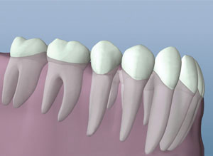 Dental model showing tooth cross-sections with white crowns on pink gum base for endodontic education.
