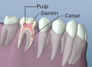 Anatomical diagram of tooth cross-section showing pulp, dentin, and canal structure in dental context.