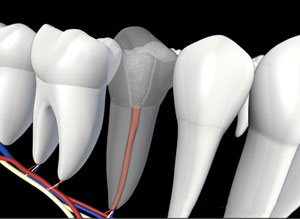 3D dental illustration showing cross-section of tooth with root canal treatment anatomy and nerves.
